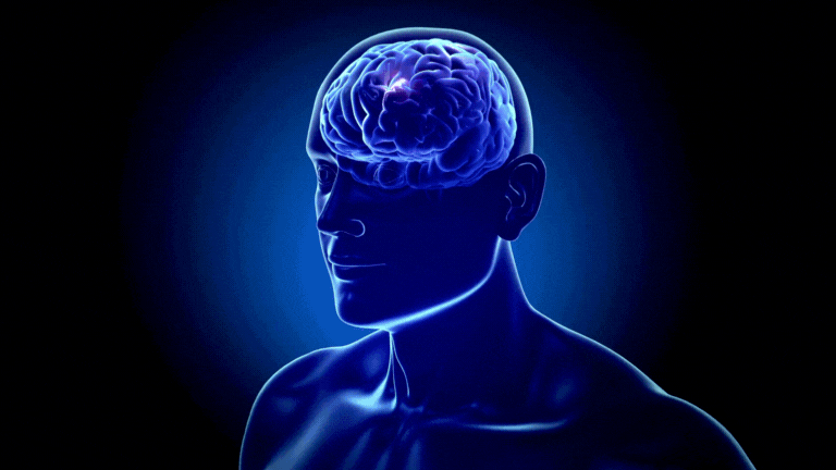 Alt Image